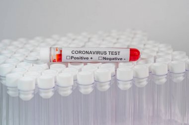 非洲豬瘟病毒熒光PCR核酸檢測試劑盒圖3
